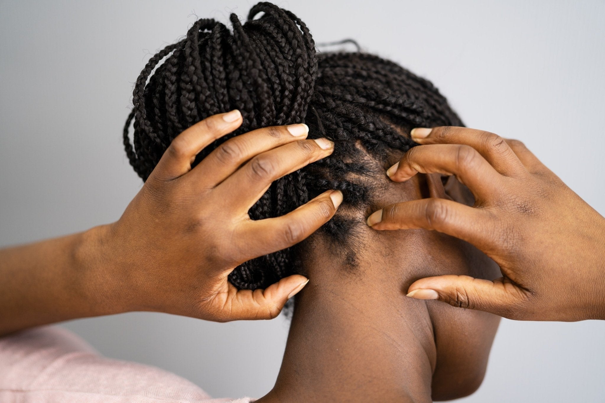 How to treat and nourish your scalp to reduce itchy and irritated scalp