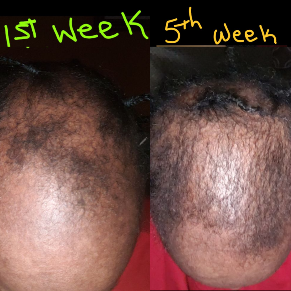 Boost Your Hair Growth in 90 Days with Nae Nae s Naturals